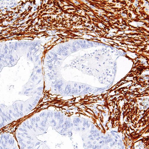 Actin (Smooth Muscle)