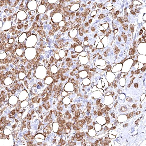 Acetyl-CoA Carboxylase 1