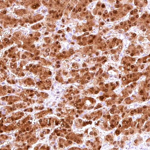 Arginase-1