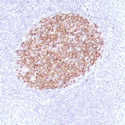 CD10