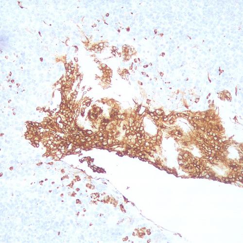 CD11b