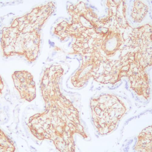Collagen IV