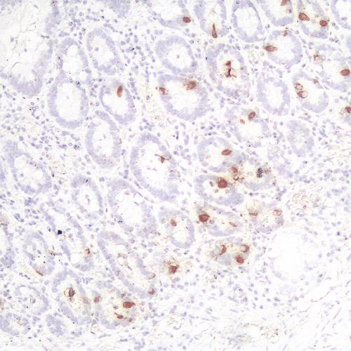 Gastrin