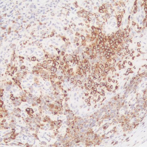Tyrosinase
