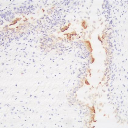 Uroplakin III